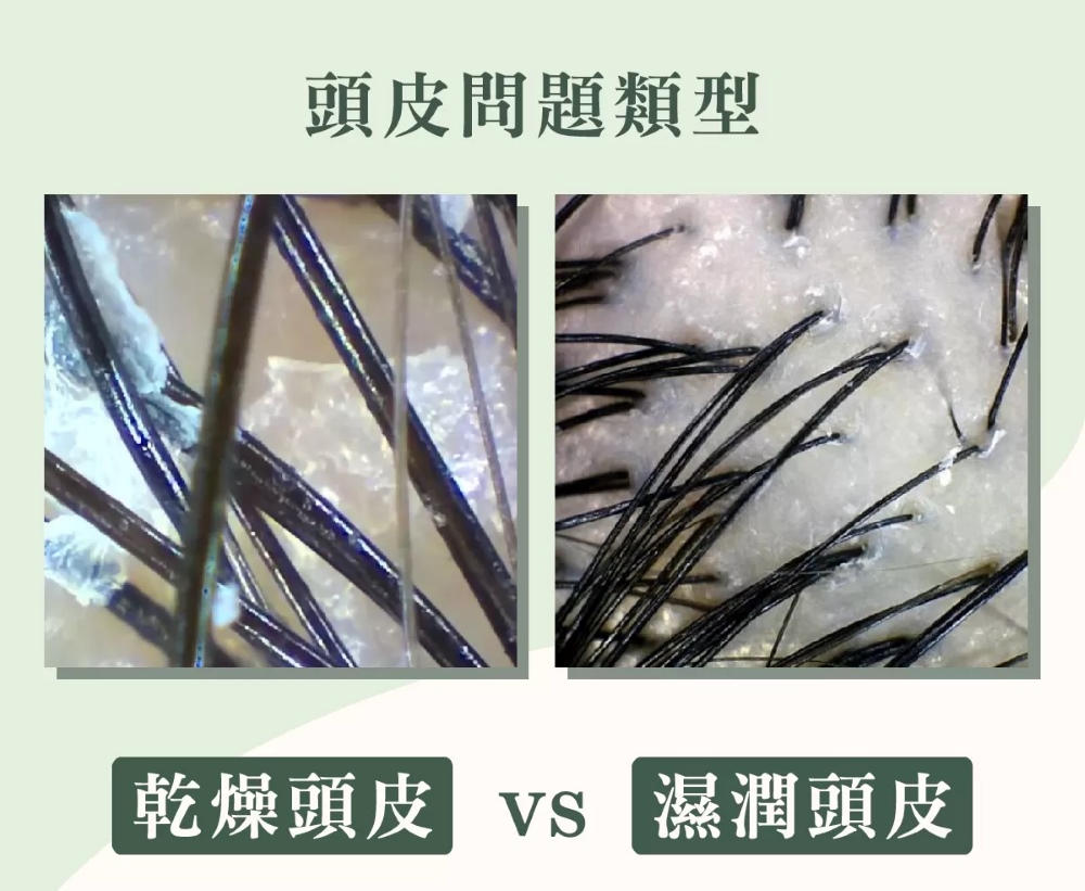 MG瑪格諾莉雅 頭皮精華液80ml
