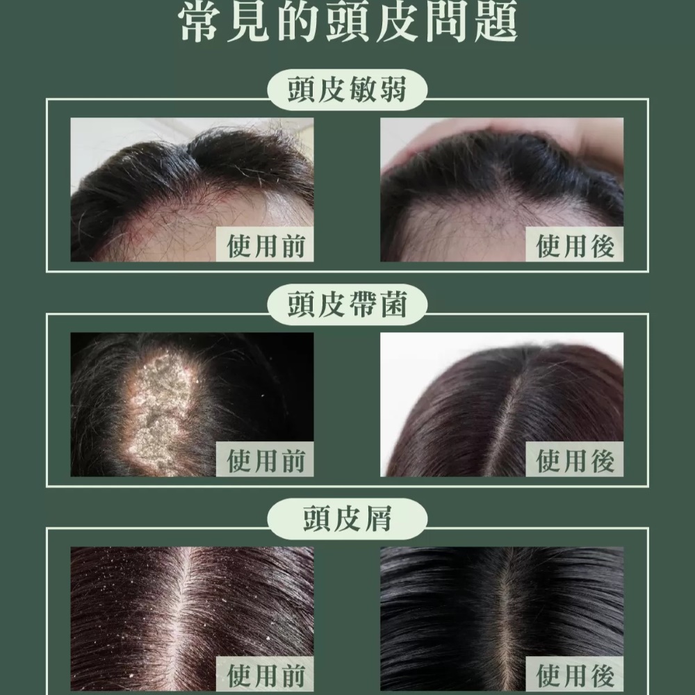 MG瑪格諾莉雅 頭皮精華液80ml