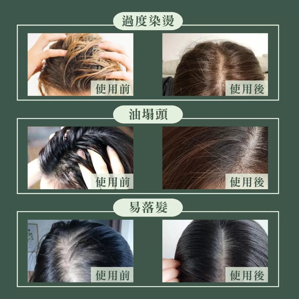 MG瑪格諾莉雅 頭皮精華液80ml
